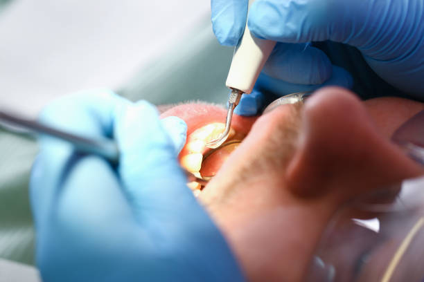 Best Dentist for Tooth Abscess  in Woodsboro, TX